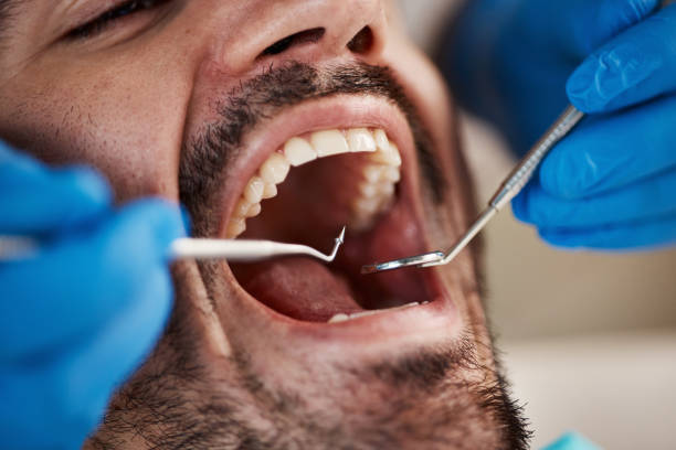 Best Emergency Dental Care for Broken or Chipped Teeth in Neuse Forest, NC